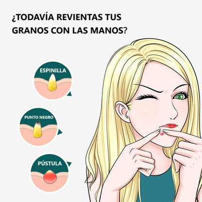 MR. GREEN REMOVEDOR DE ESPINILLAS